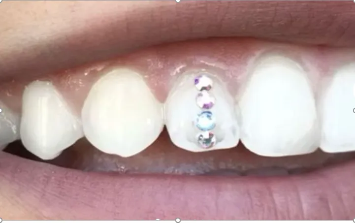 29086 dental checkup