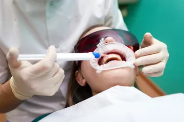29086 teeth whitening grapevine 4