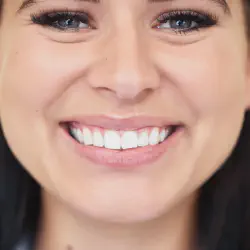 /img/29086-teeth-whitening-smile.webp