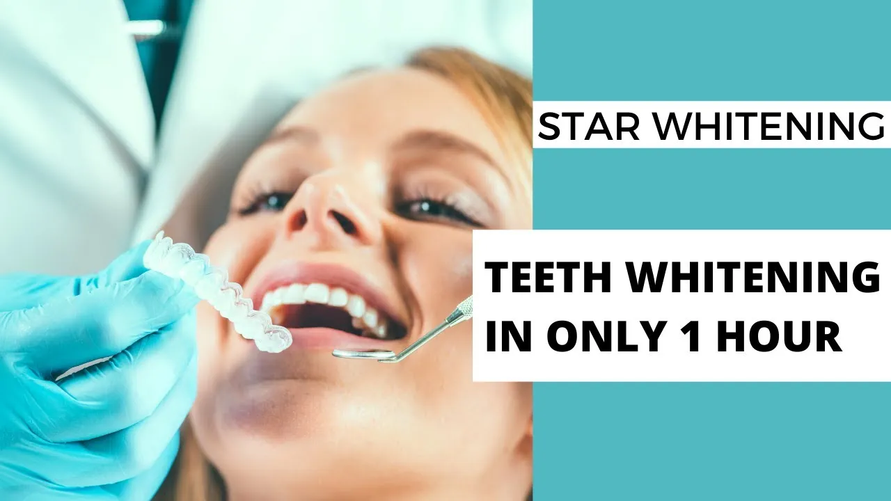 29087 at home whitening kits