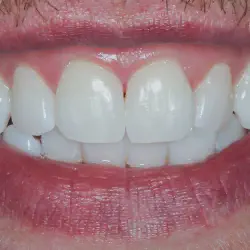 /img/29088-regular-dental-checkups-dublin.webp