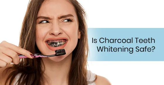 29091 charcoal teeth whitening products