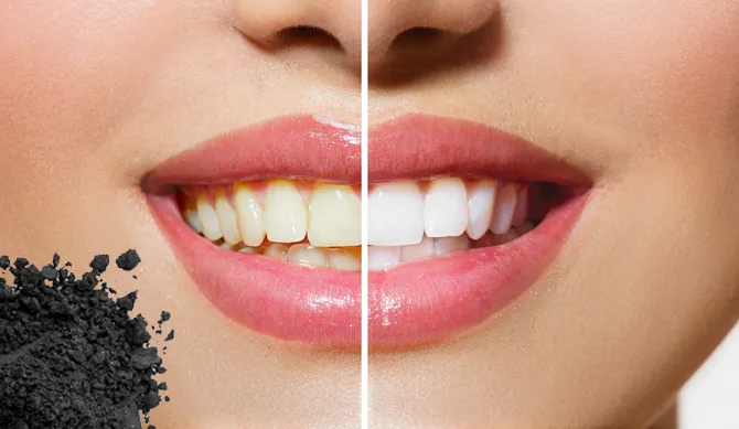 29091 teeth enamel erosion