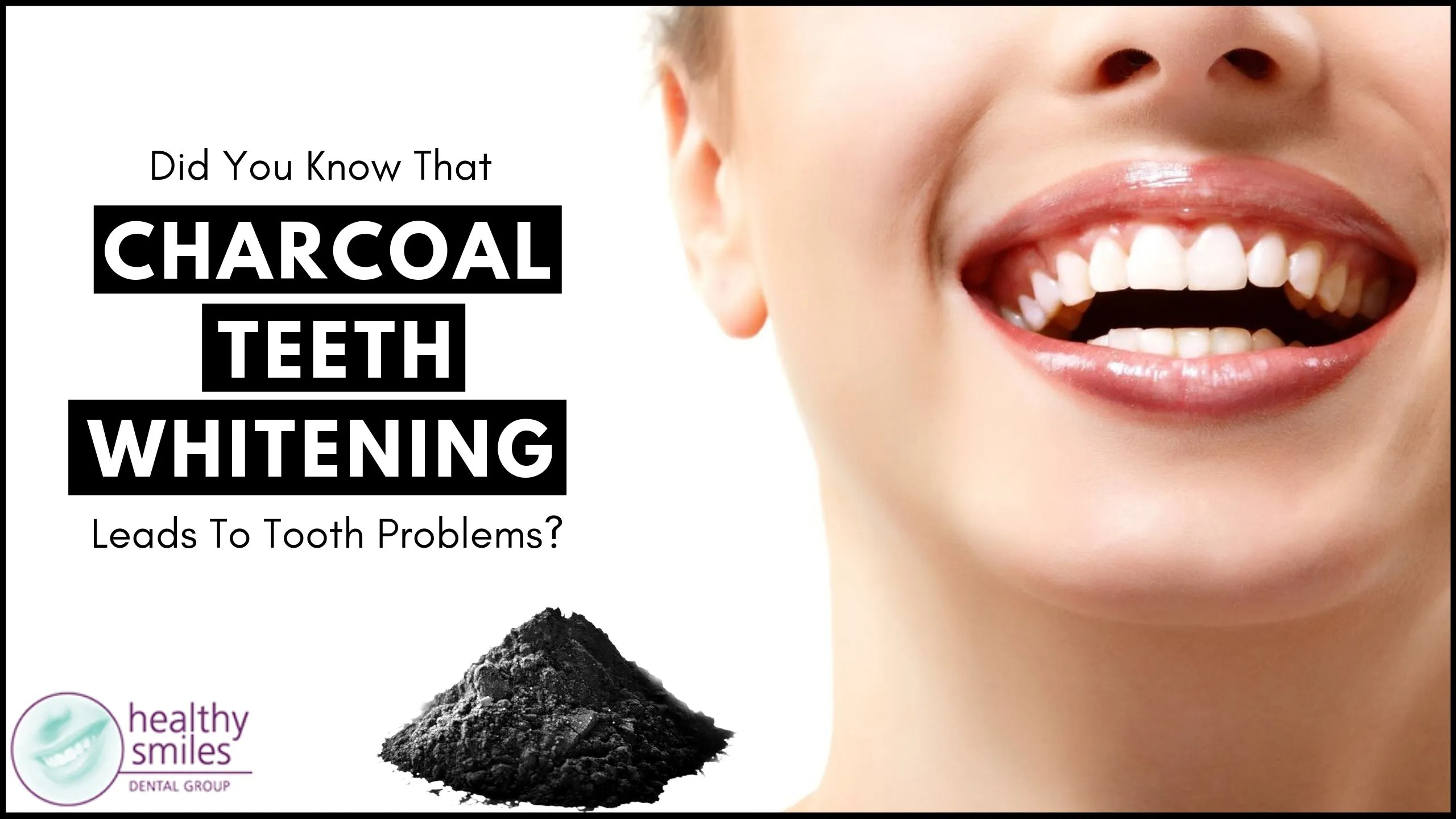 29091 teeth whitening results