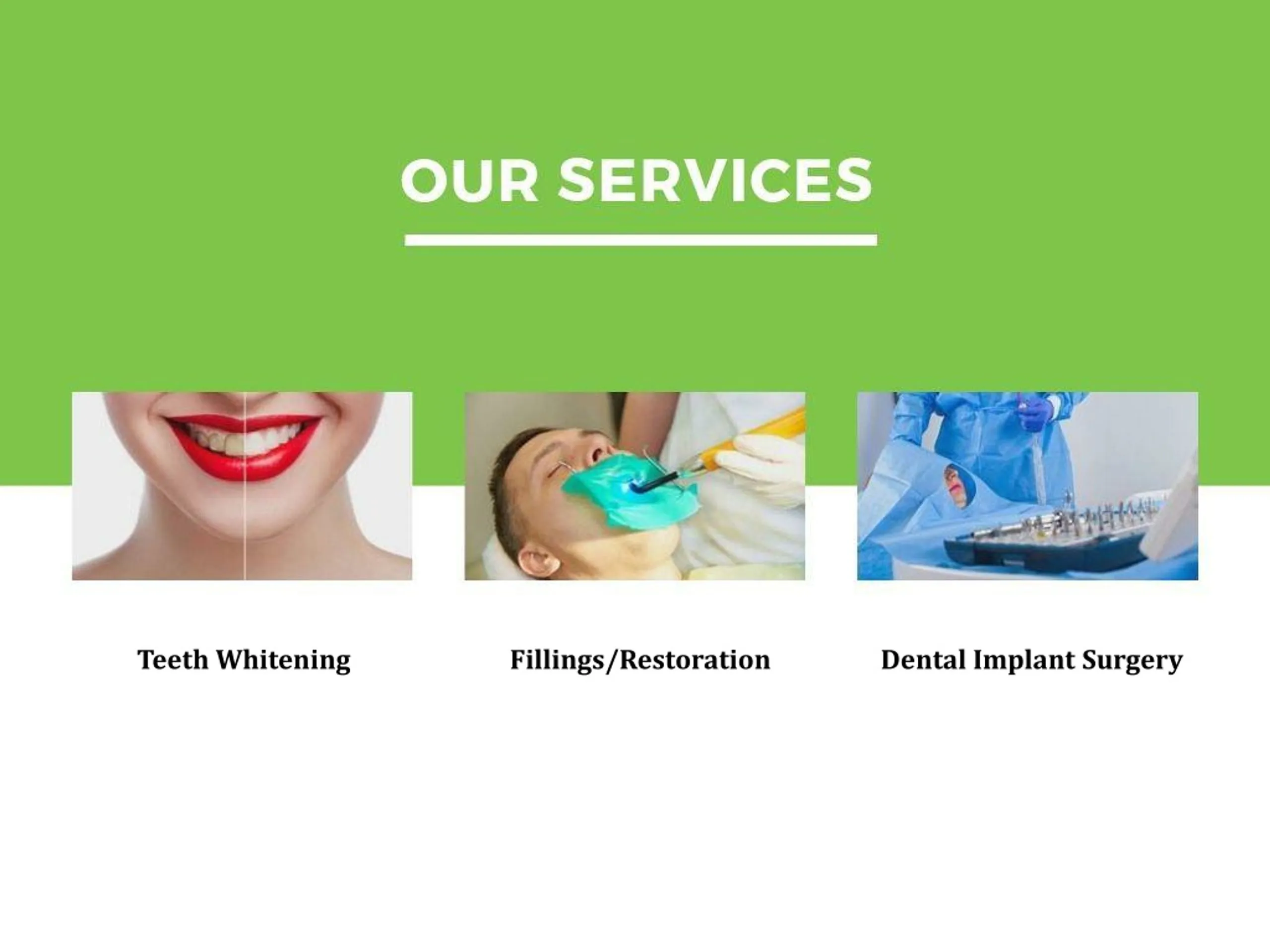 29093 in office teeth whitening