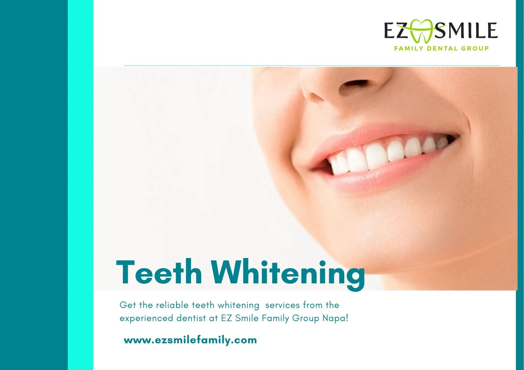 29093 tooth discoloration causes