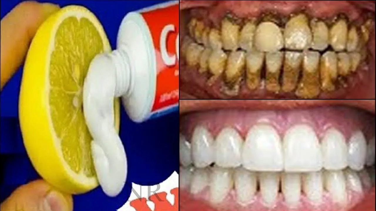 /img/29095-oral-hygiene-practices.webp