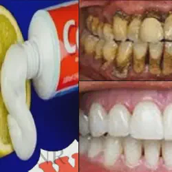 /img/29095-oral-hygiene-practices.webp