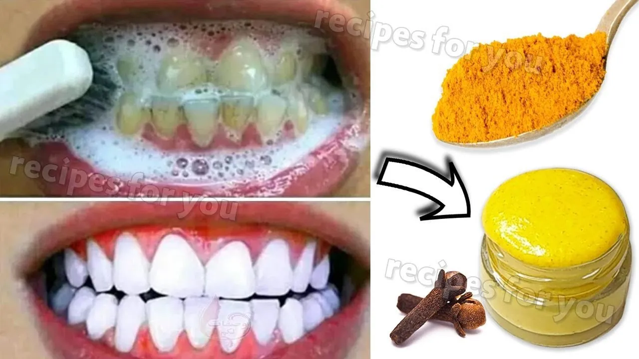 29095 whitening toothpaste