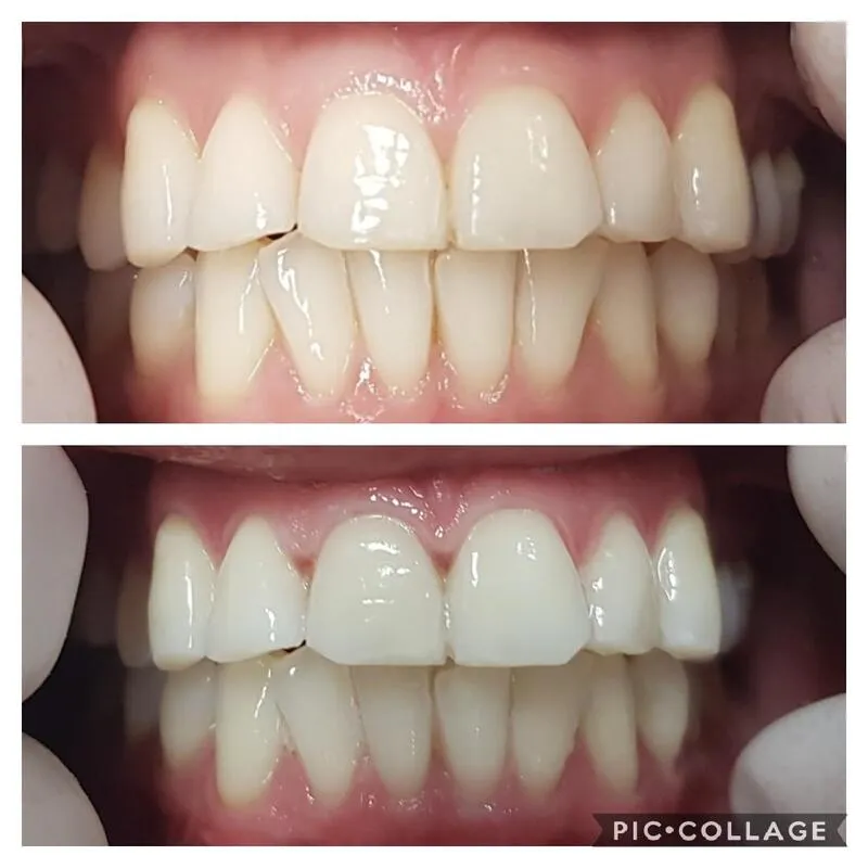 29101 nh dentist