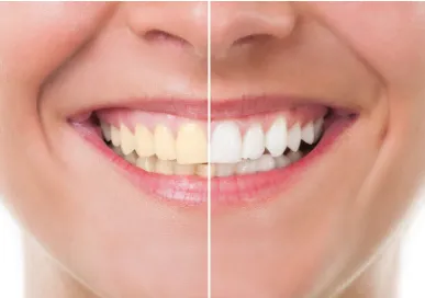 /img/29104-maintaining-white-smile.webp