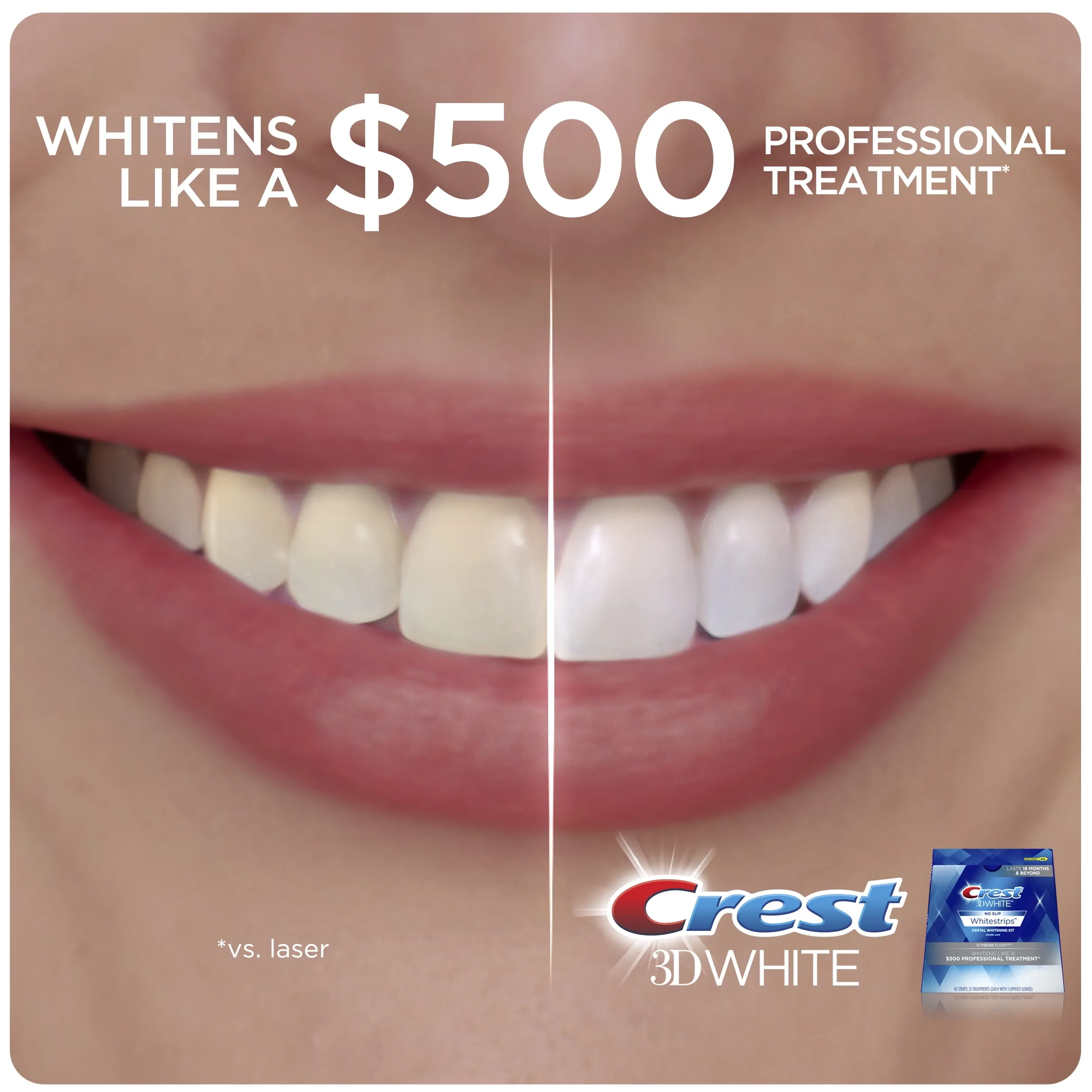 29106 teeth staining comparison