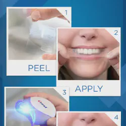 /img/29106-teeth-whitening-alternatives.webp