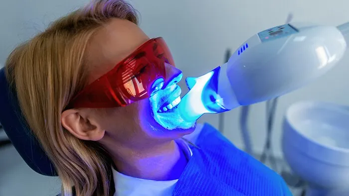 /img/29107-teeth-whitening-usa-considerations.webp