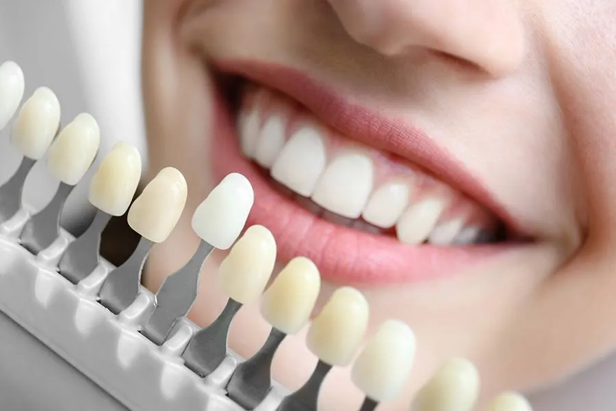 /img/29108-bright-smile-maintenance.webp