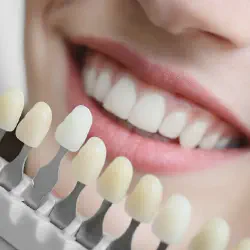 /img/29108-bright-smile-maintenance.webp