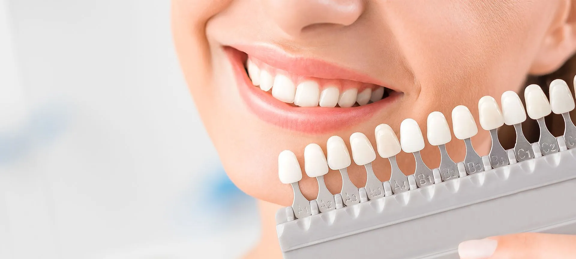29108 professional teeth whitening
