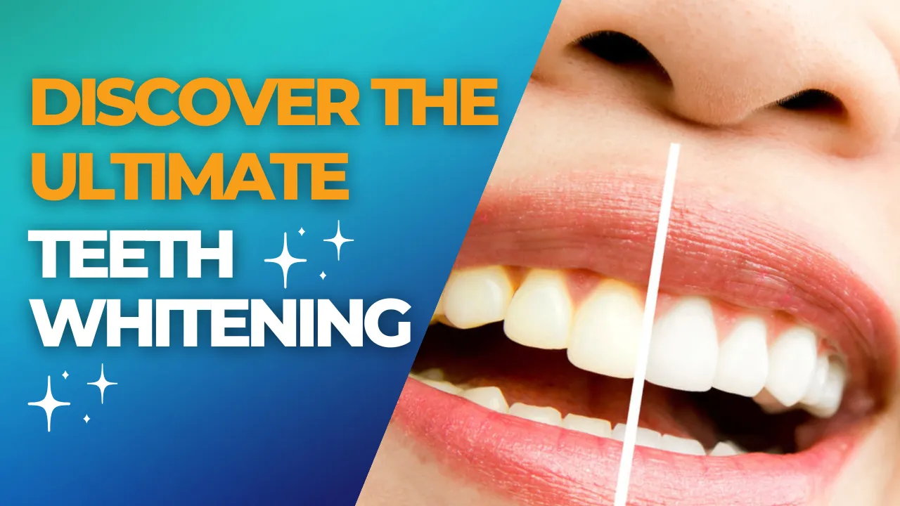 29108 whitening treatment options