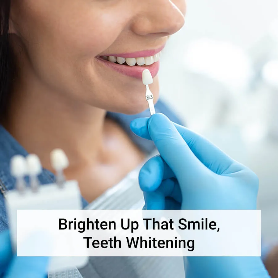 29112 teeth whitening las vegas 4