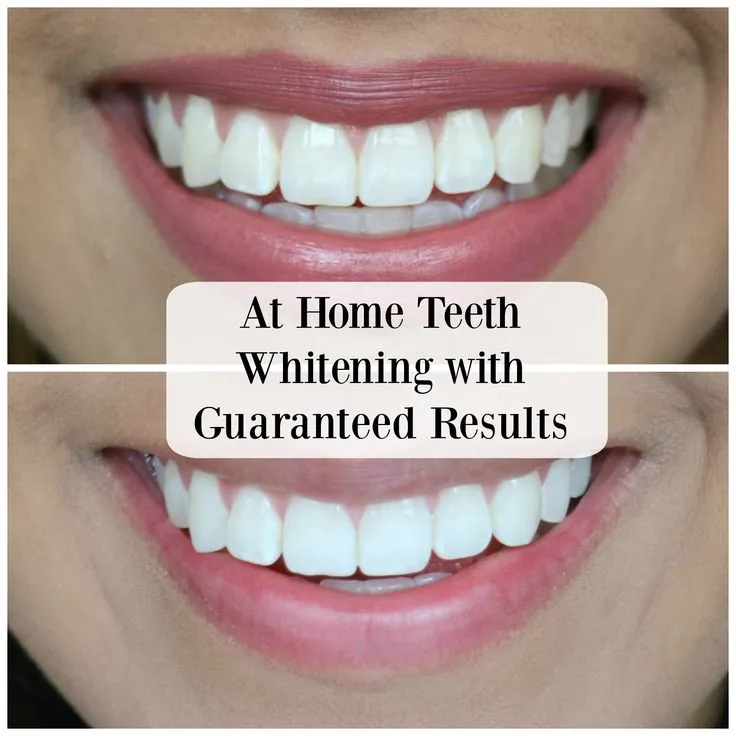 29113 finding dentist insurance