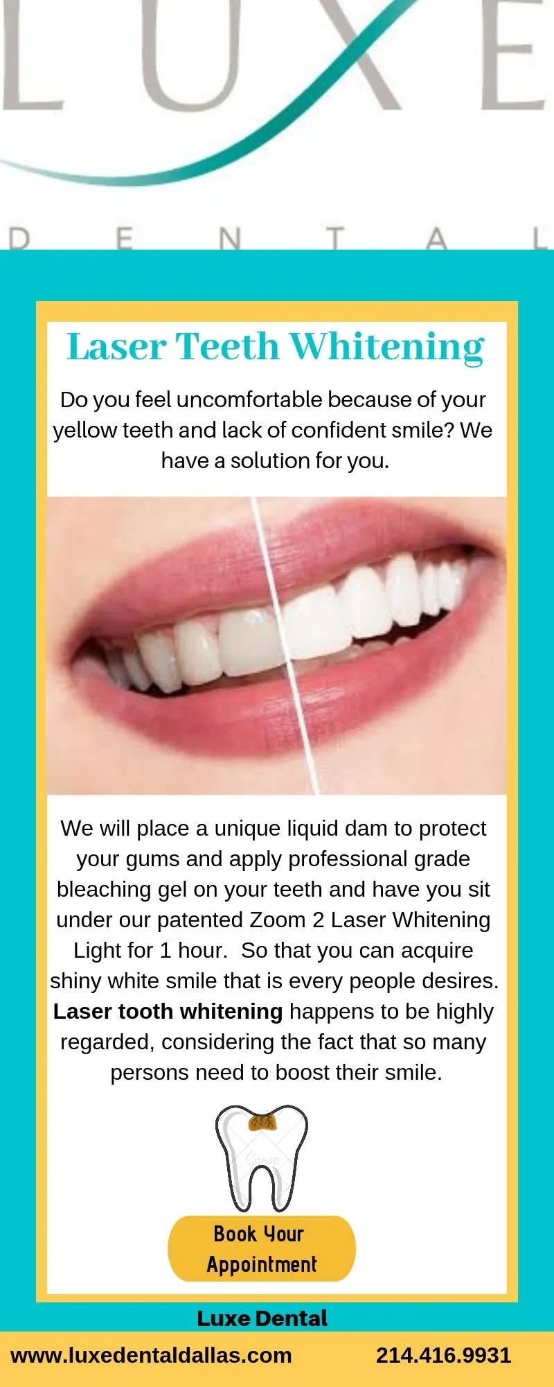 29113 teeth whitening procedures