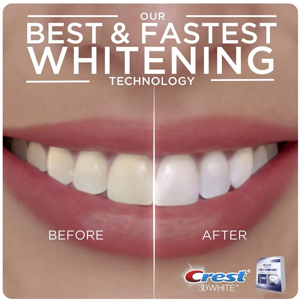 /img/29114-teeth-whitening-at-home.webp