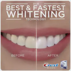/img/29114-teeth-whitening-at-home.webp