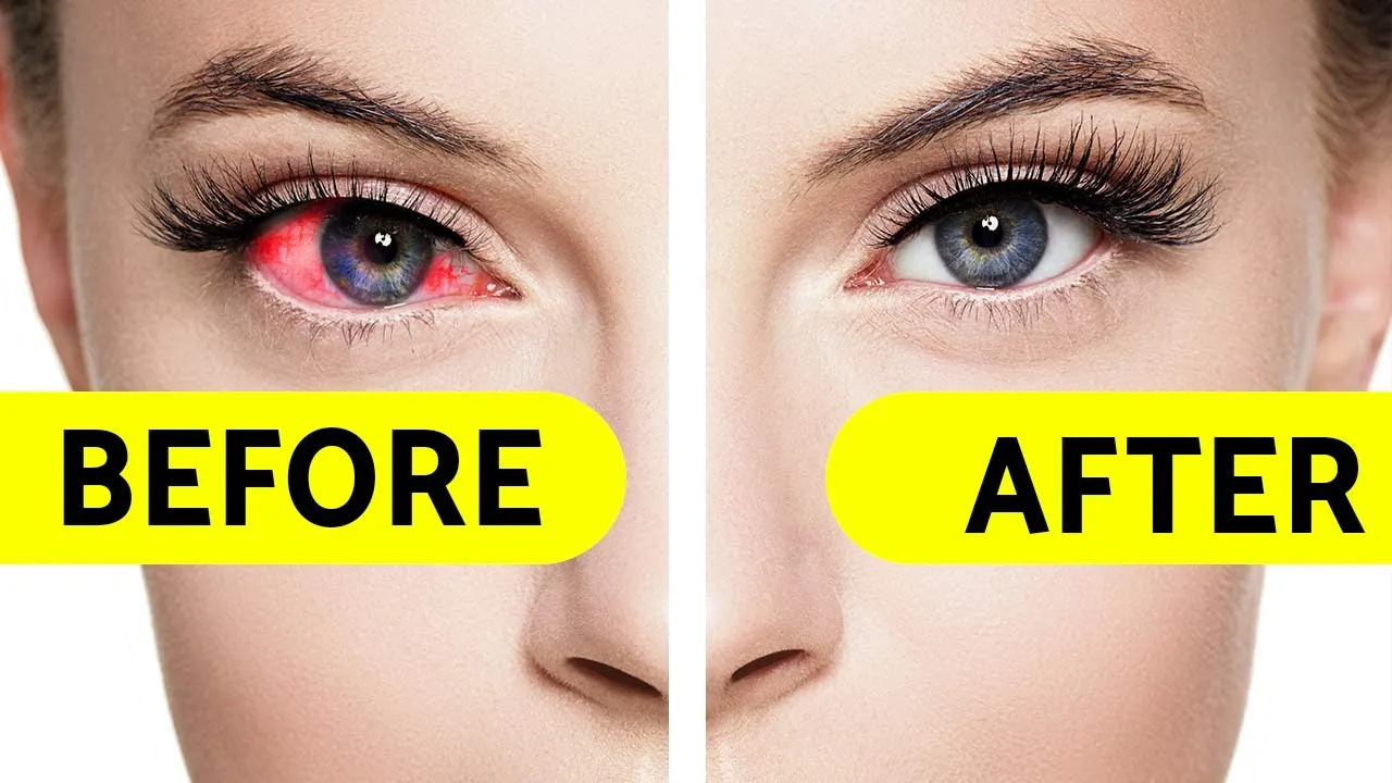 29115 eye drops types