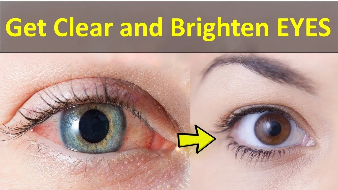 29115 sleep eye health