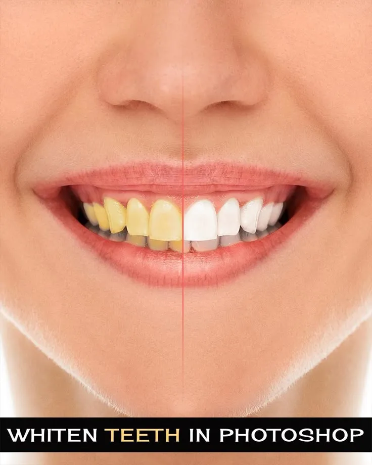 /img/29117-natural-teeth.webp