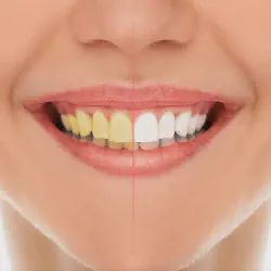/img/29117-natural-teeth.webp