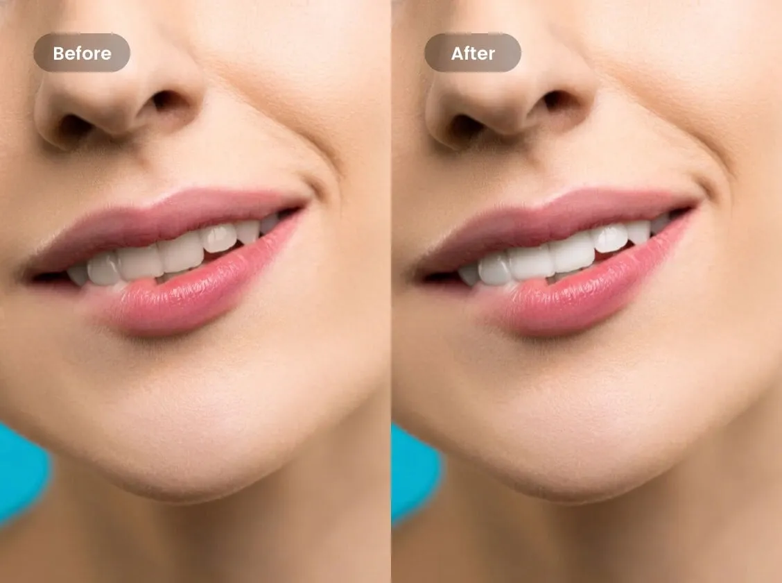 29117 teeth whitening tools