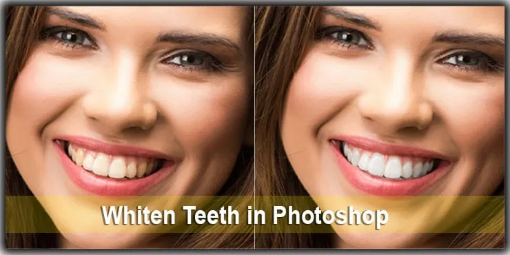 29117 whitening process