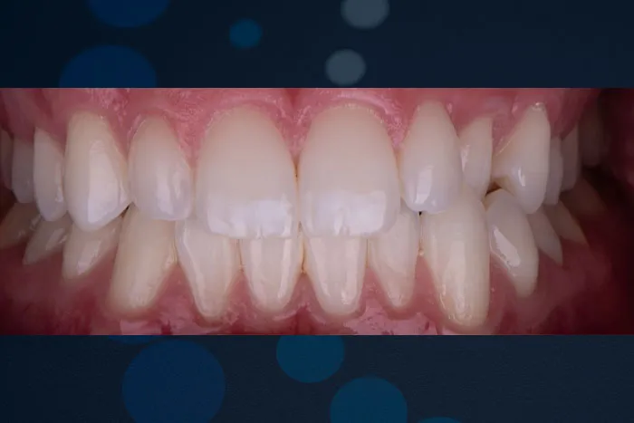 29118 dental exam