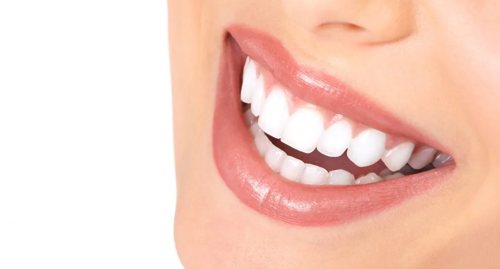 29118 white smile maintenance