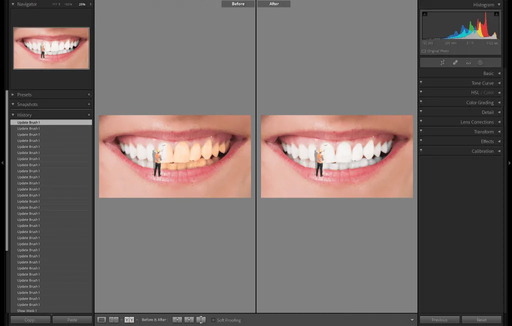 29122 color grading teeth