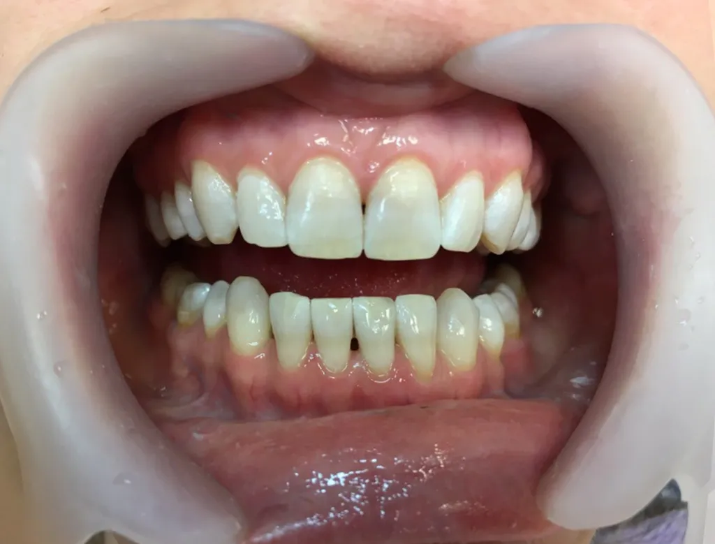 29125 teeth whitening vilnius consultation