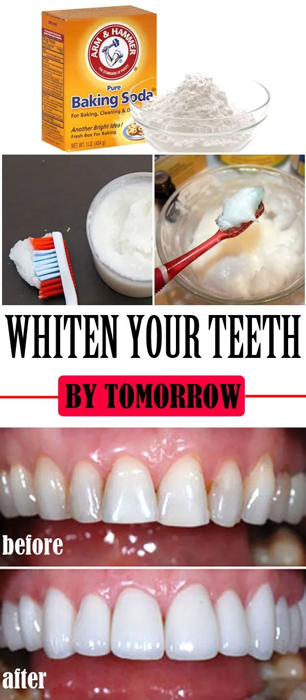 29127 sensitive teeth