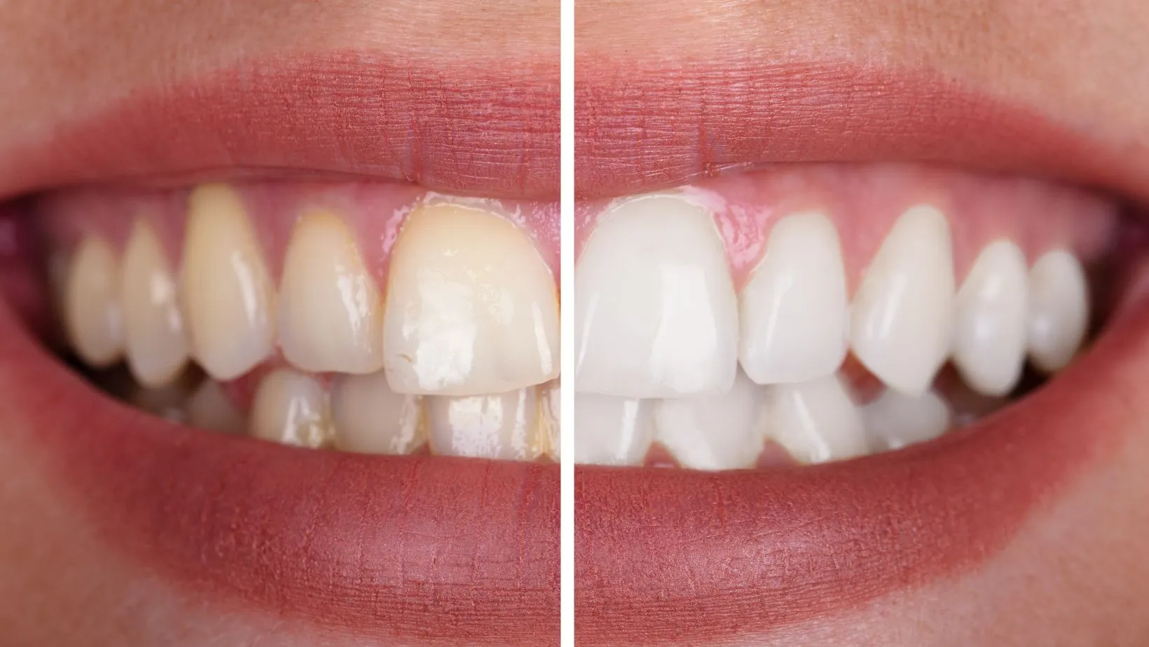 29128 sensitivity toothpaste