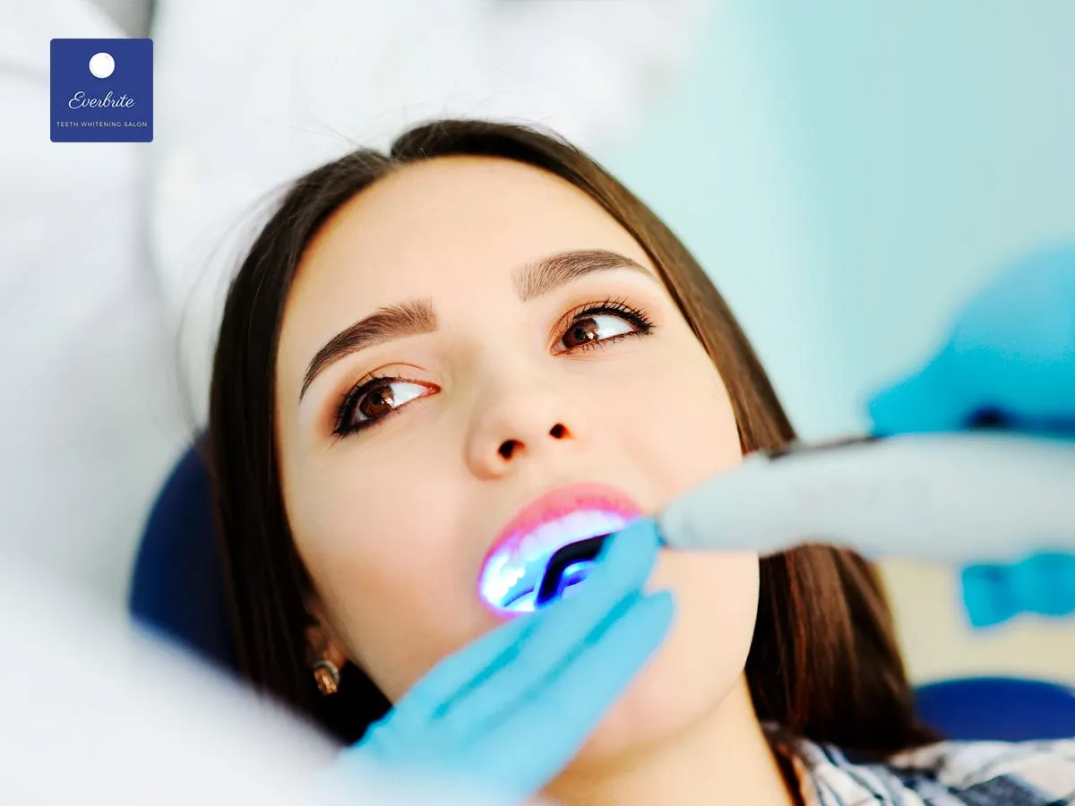 29132 at home whitening kit
