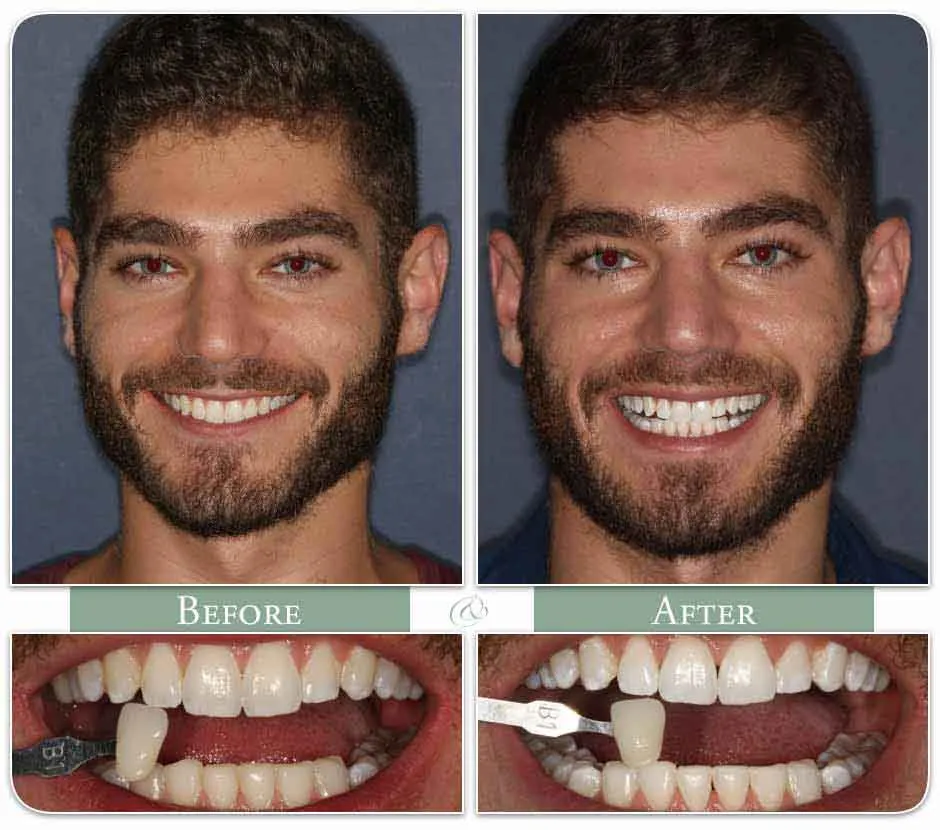 29132 healthy smile
