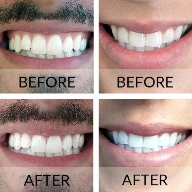 29132 whitening toothpaste