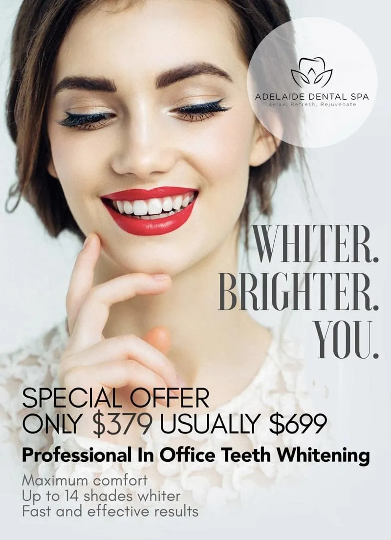 /img/29135-professional-teeth-whitening.webp