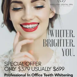 /img/29135-professional-teeth-whitening.webp