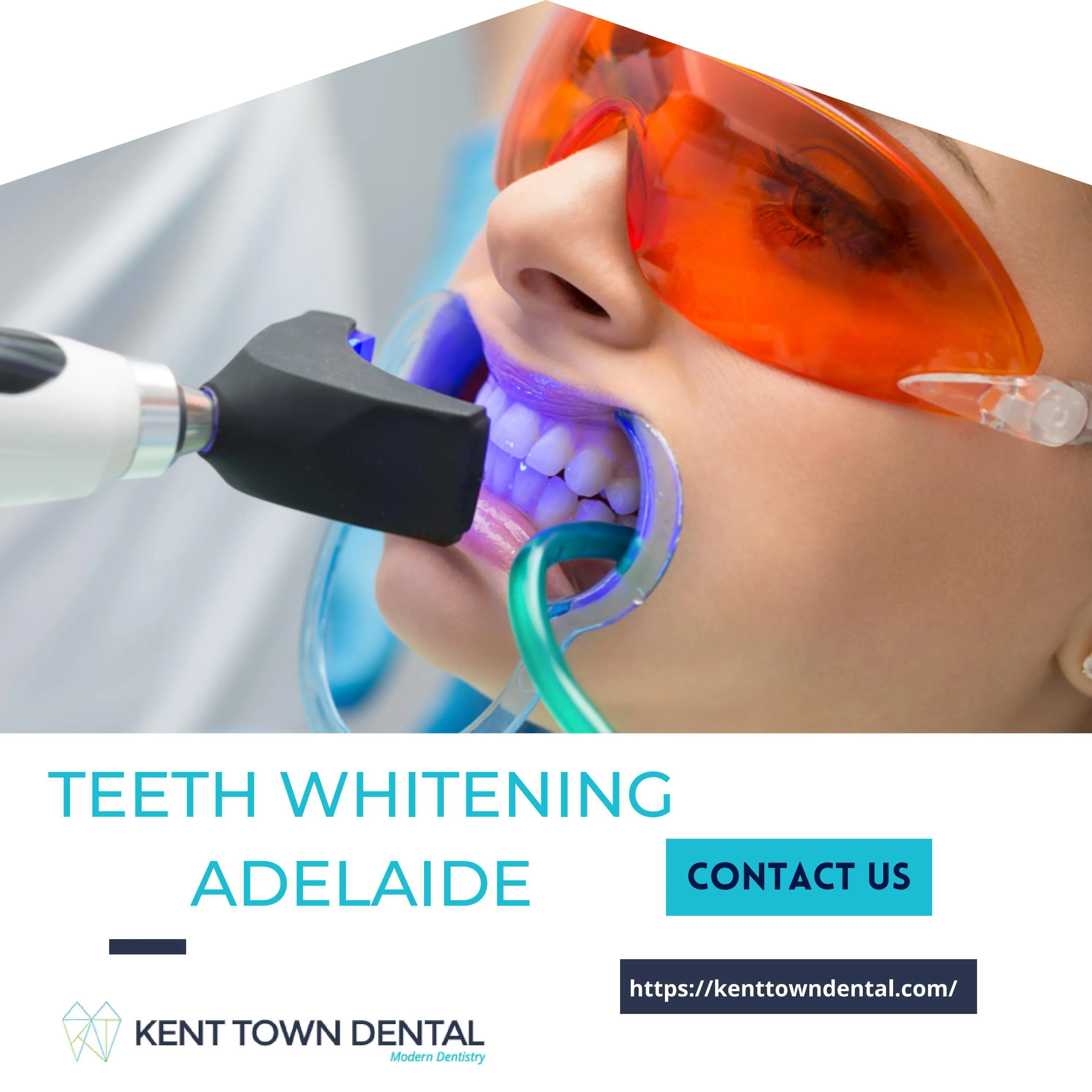 29135 teeth whitening adelaide