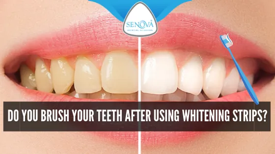 29139 brushing time for whitening