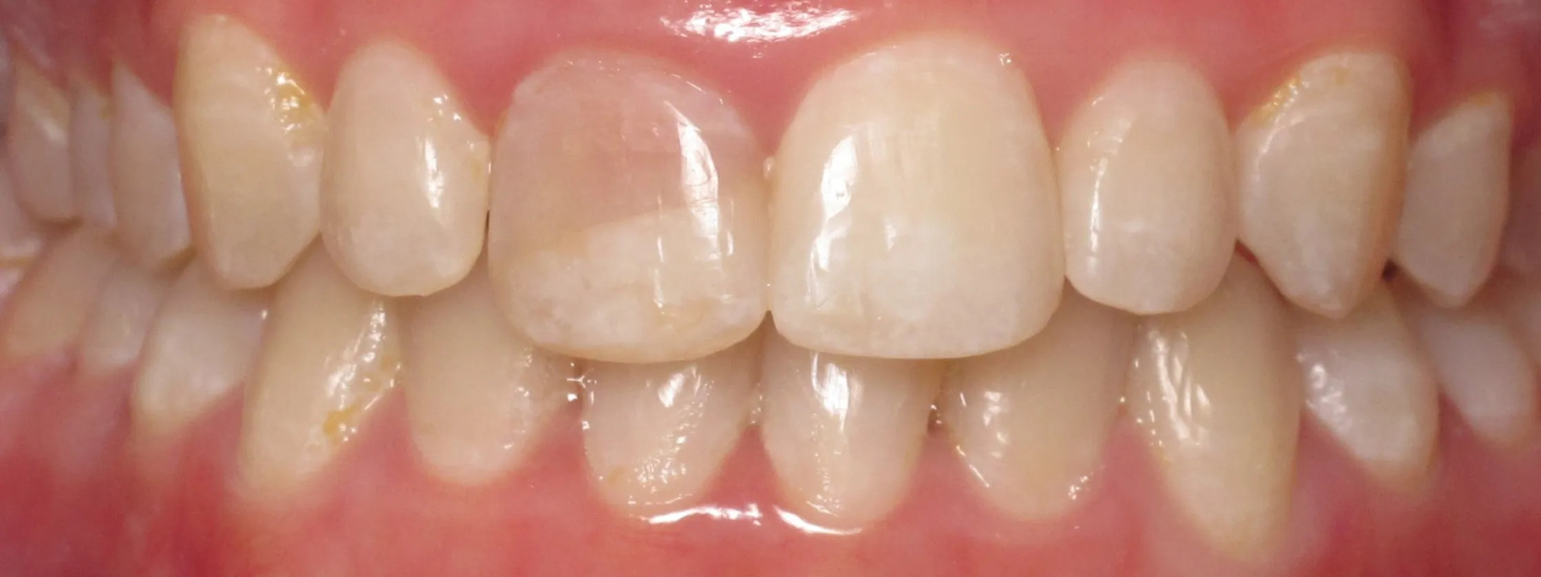 /img/29140-choosing-whitening-products.webp