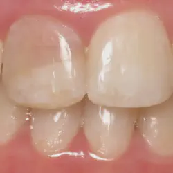 /img/29140-choosing-whitening-products.webp
