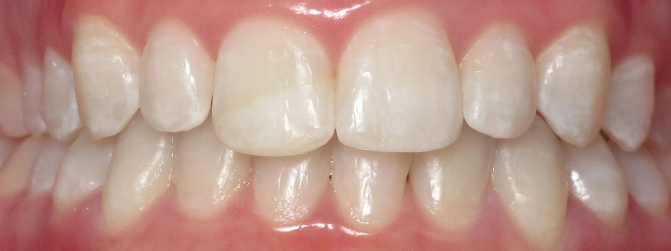 29140 oral hygiene practices