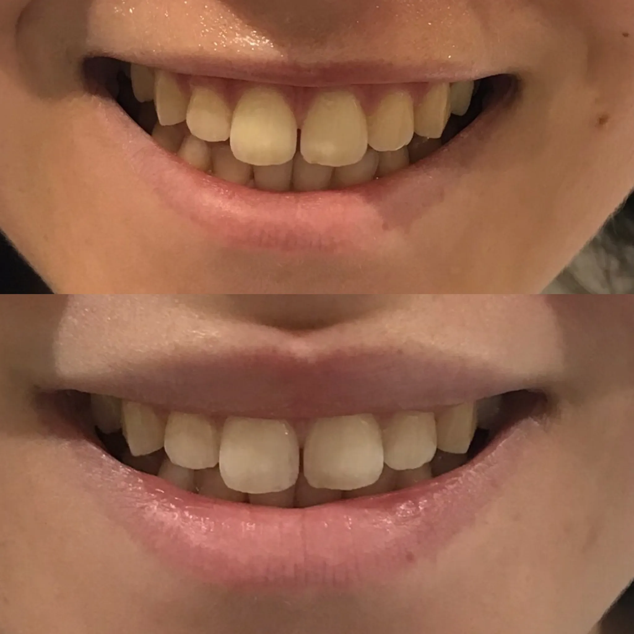 /img/29141-post-whitening-care.webp